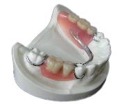 保険適用義歯